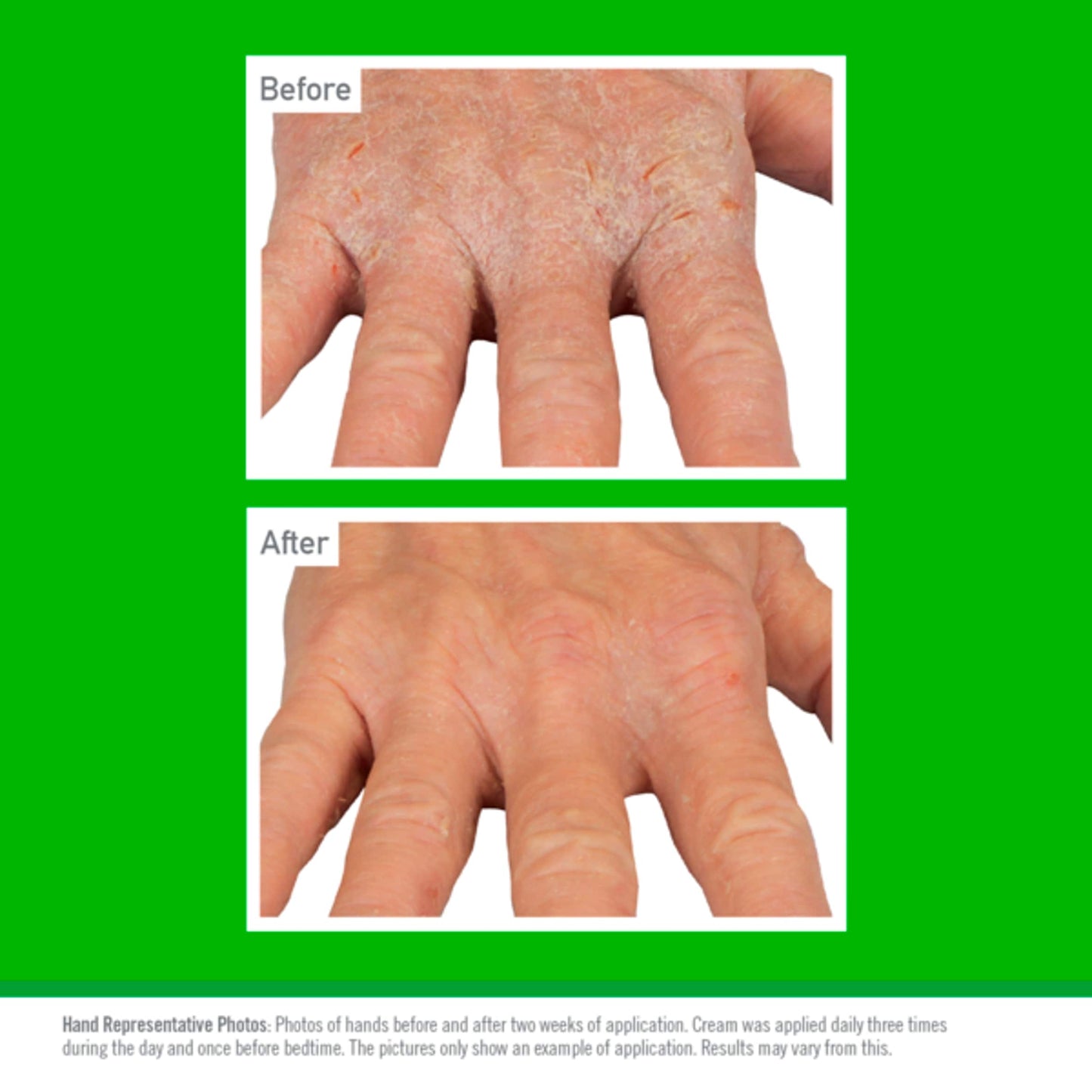 O'Keeffe's Working Hands Eczema Relief 57g — image 4