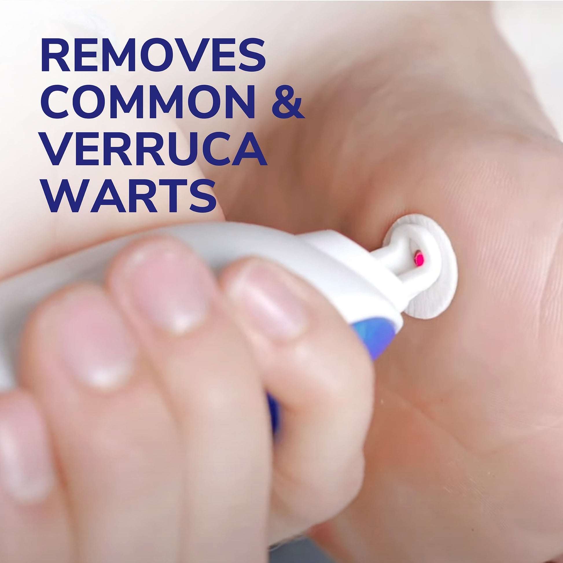 Dr Scholl's Freeze Away Max Verruca & Wart Remover 35ml — image 2