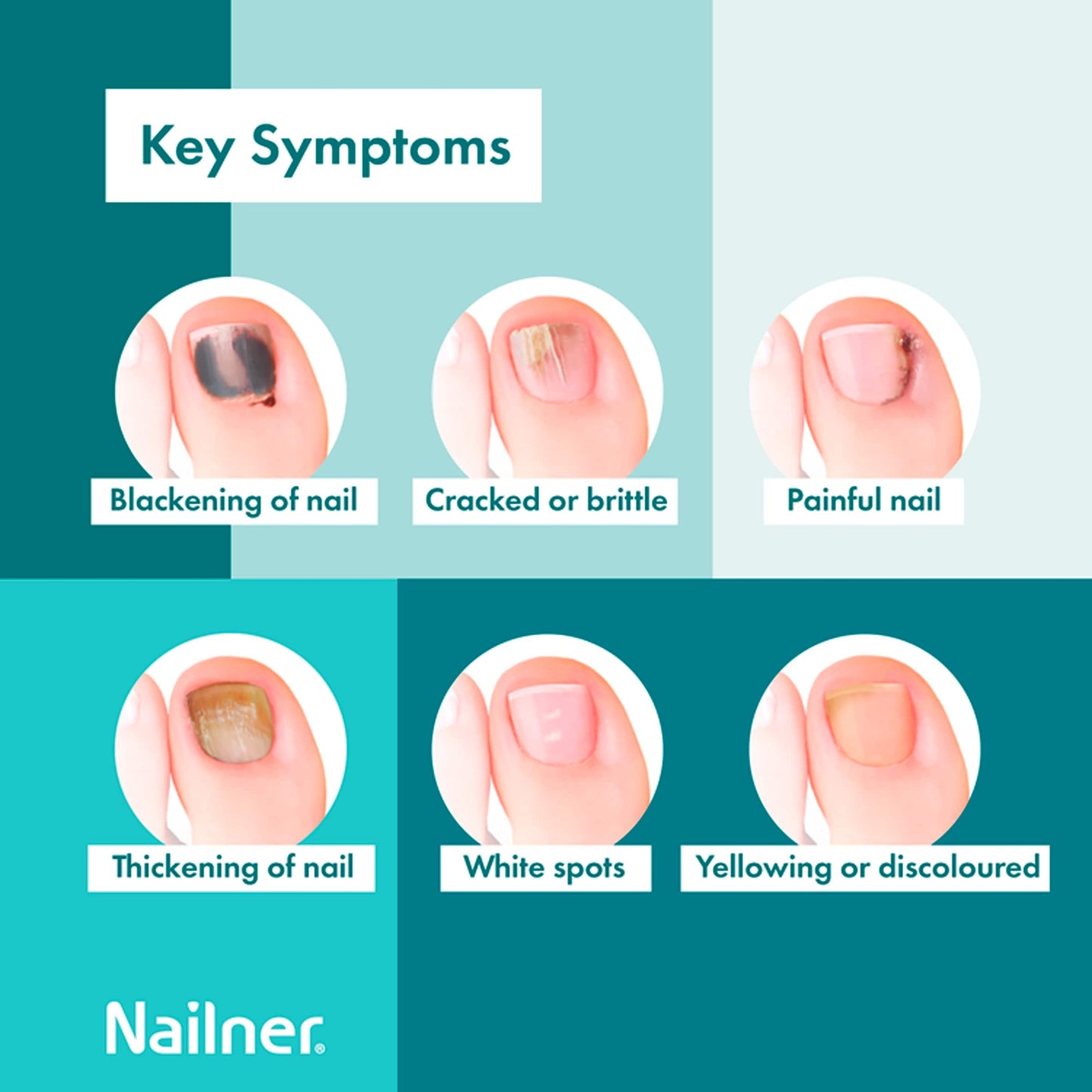 Nailner 2 in 1 Brush Antifungal Nail Treatment 5ml for Fungal Nails — image 3