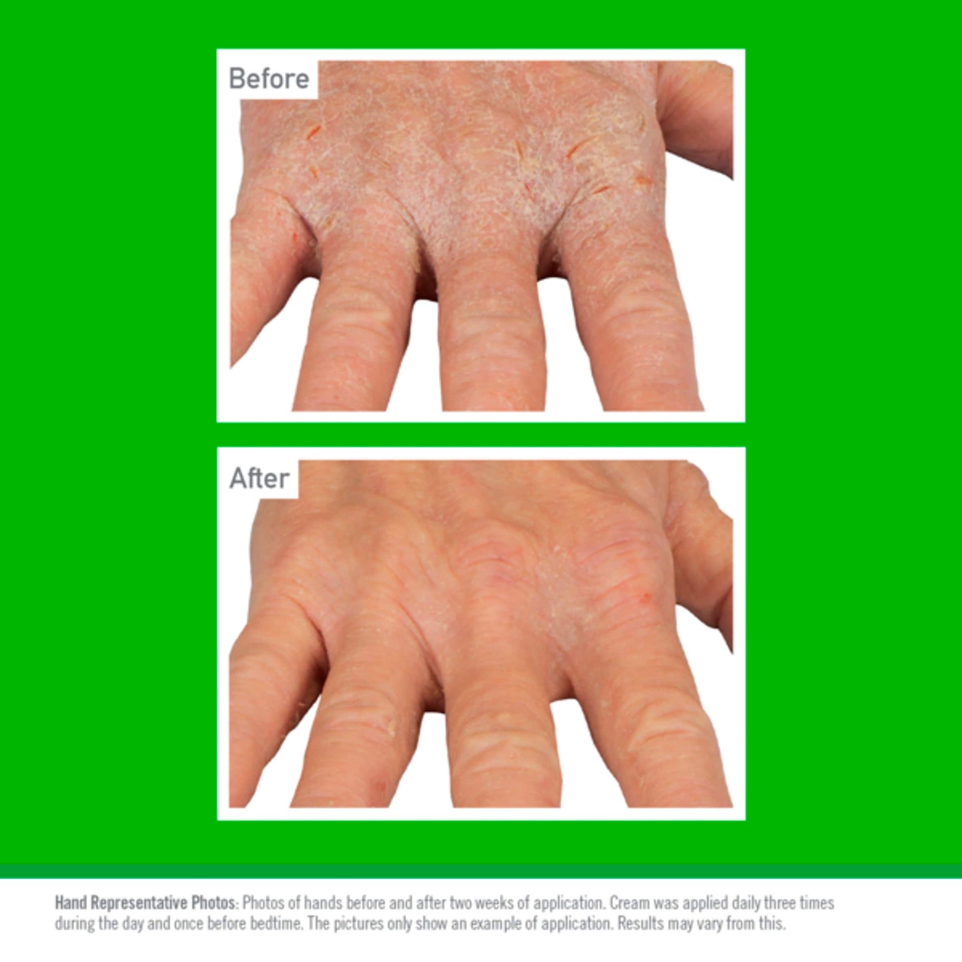 O'Keeffe's Working Hands Eczema Relief 57g — image 4