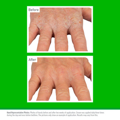 O'Keeffe's Working Hands Eczema Relief 57g — image 4