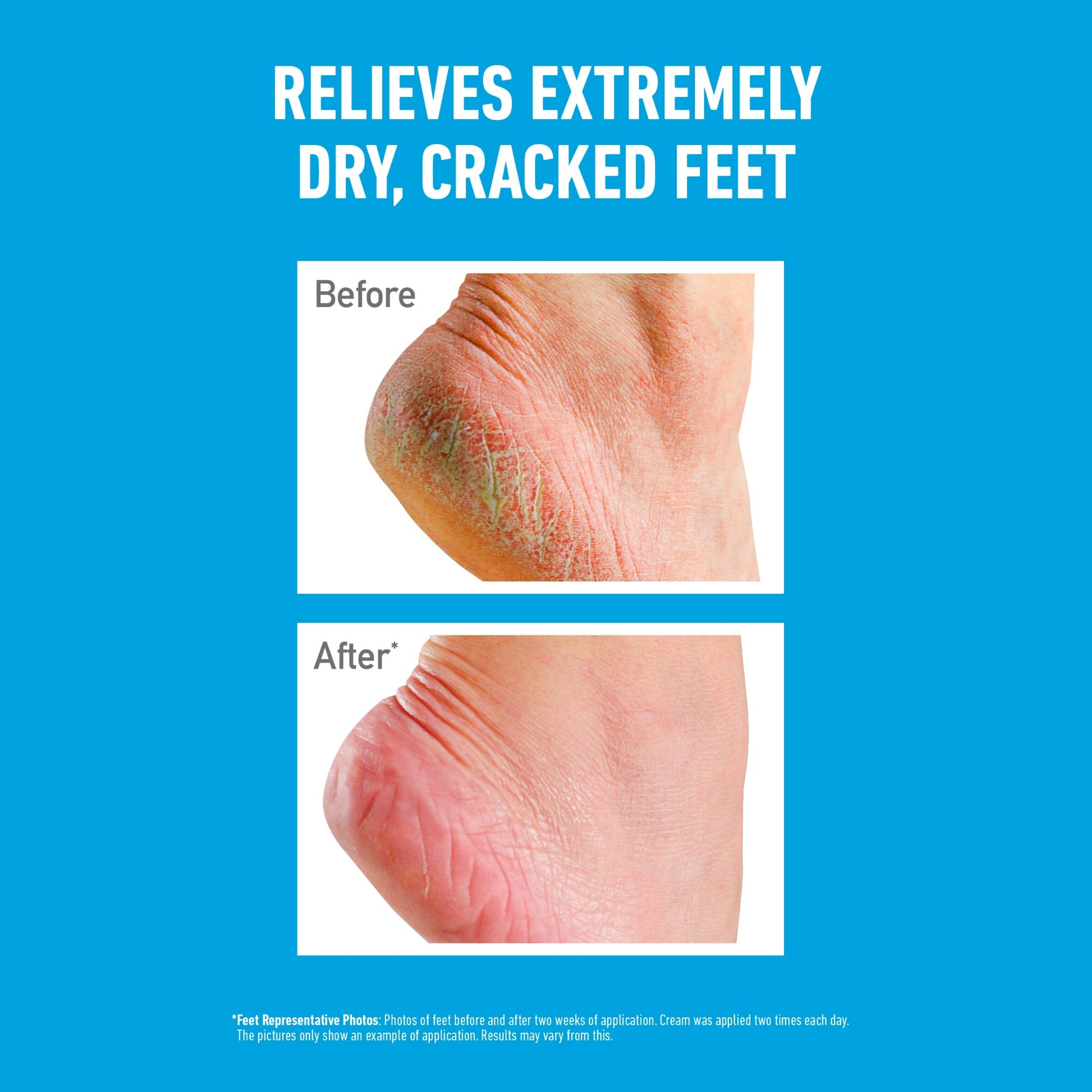 O'keeffees Healthy Foot Cream Jar 91G — image 3