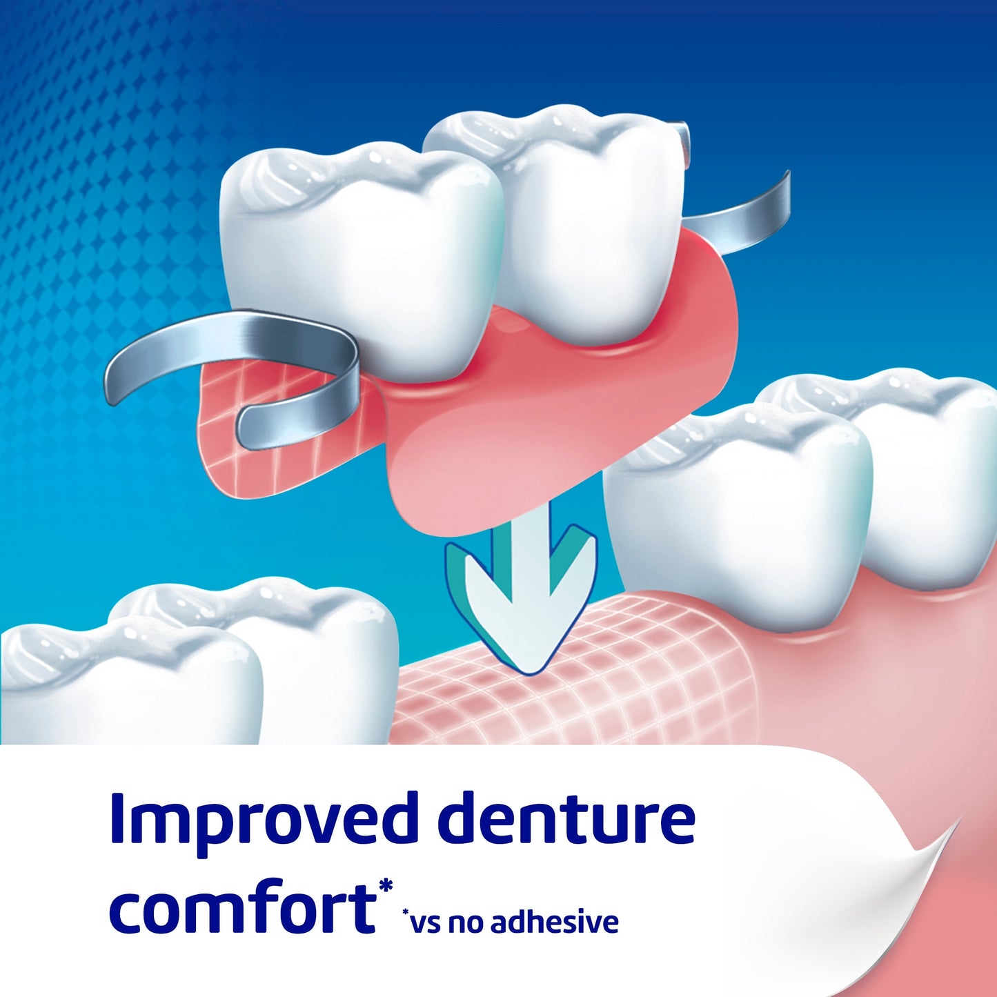 Poligrip Flavour Free Denture Fixative Cream 40g — image 4